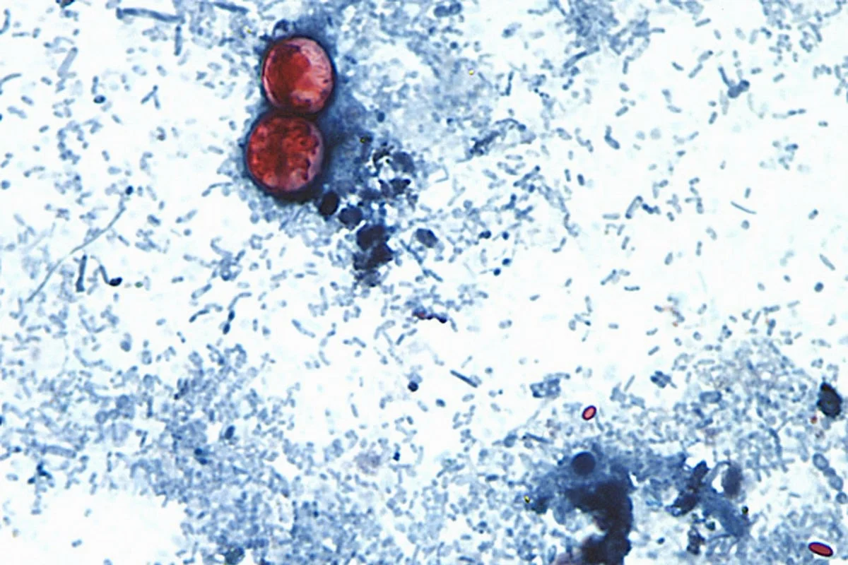 Cyclospora found at Mexican farmed linked to lettuce outbreak, FDA says